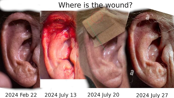 Whereisthewound