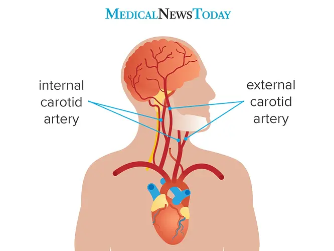 carotid-arteries_ver3