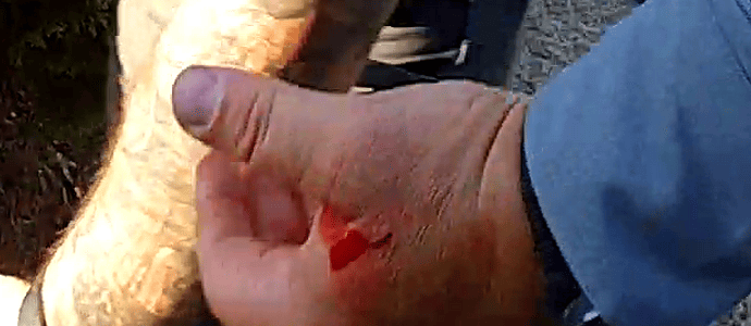 bleeding