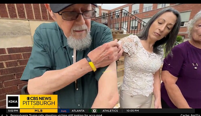 CopenhaverScarPosition