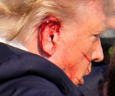 Trump bloodied ear